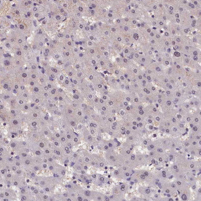 ZC3H4 Antibody in Immunohistochemistry (IHC)