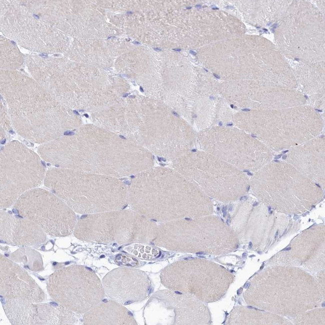 OCIAD2 Antibody in Immunohistochemistry (IHC)