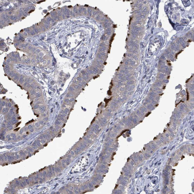 POMGNT2 Antibody in Immunohistochemistry (IHC)