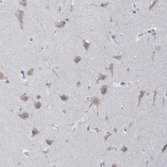 POMGNT2 Antibody in Immunohistochemistry (IHC)