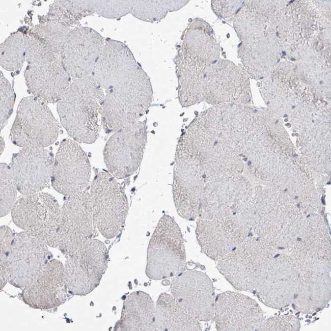 POMGNT2 Antibody in Immunohistochemistry (IHC)