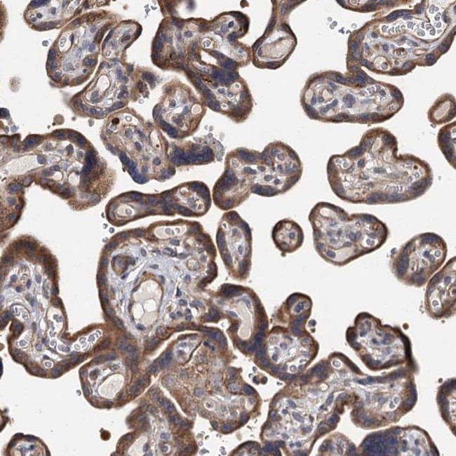 KIAA1609 Antibody in Immunohistochemistry (IHC)