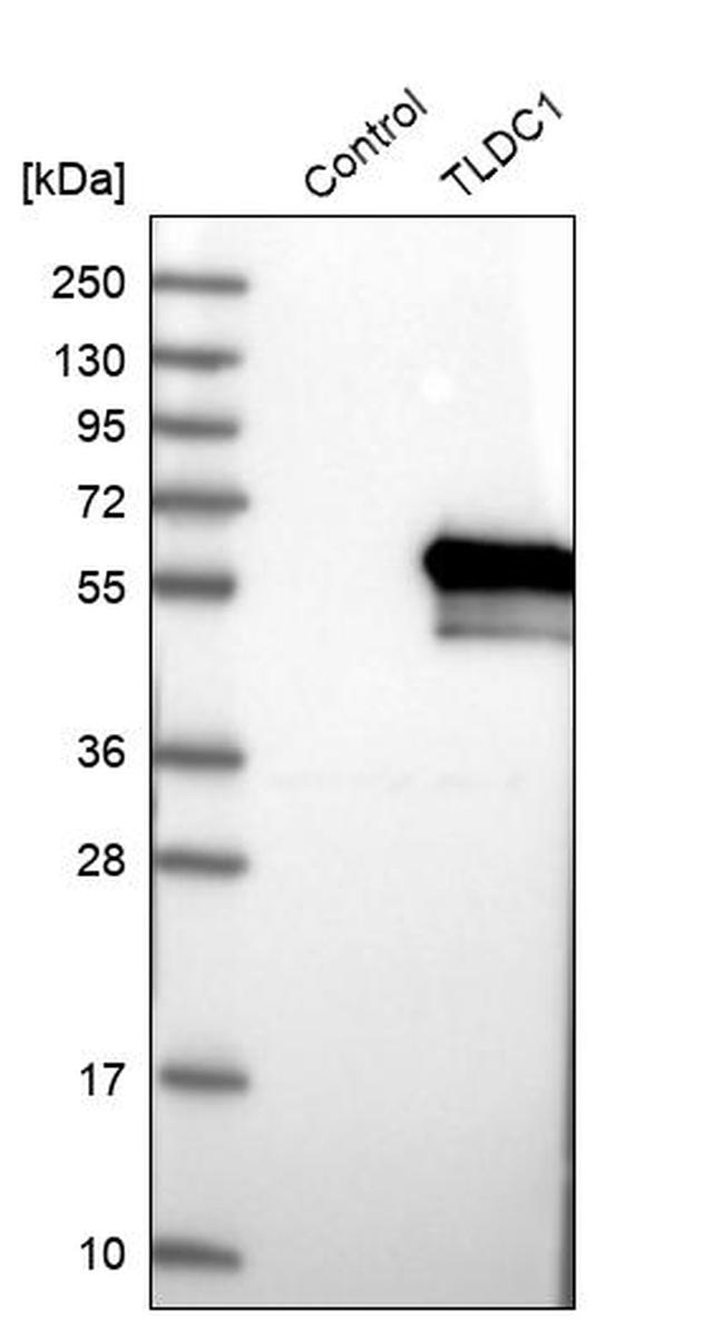 KIAA1609 Antibody in Western Blot (WB)