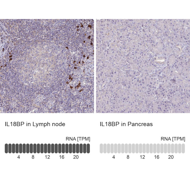 IL18BP Antibody in Immunohistochemistry (IHC)