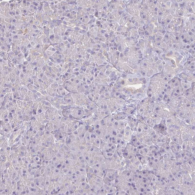 IL18BP Antibody in Immunohistochemistry (IHC)