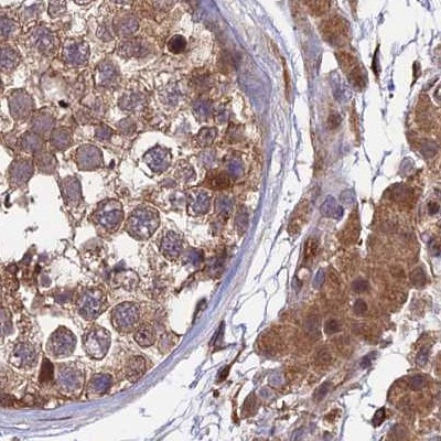 MKKS Antibody in Immunohistochemistry (IHC)