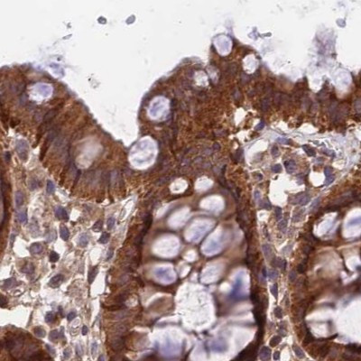 MKKS Antibody in Immunohistochemistry (IHC)