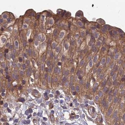 MKKS Antibody in Immunohistochemistry (IHC)