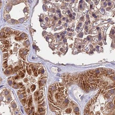 MKKS Antibody in Immunohistochemistry (IHC)