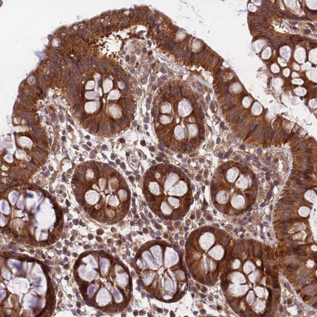 MKKS Antibody in Immunohistochemistry (IHC)