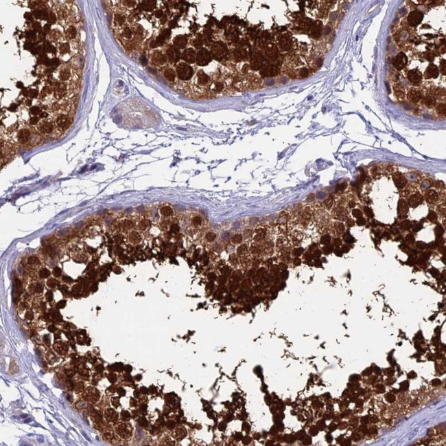 IGSF6 Antibody in Immunohistochemistry (IHC)