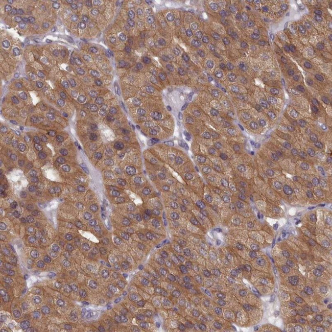 WDR59 Antibody in Immunohistochemistry (IHC)