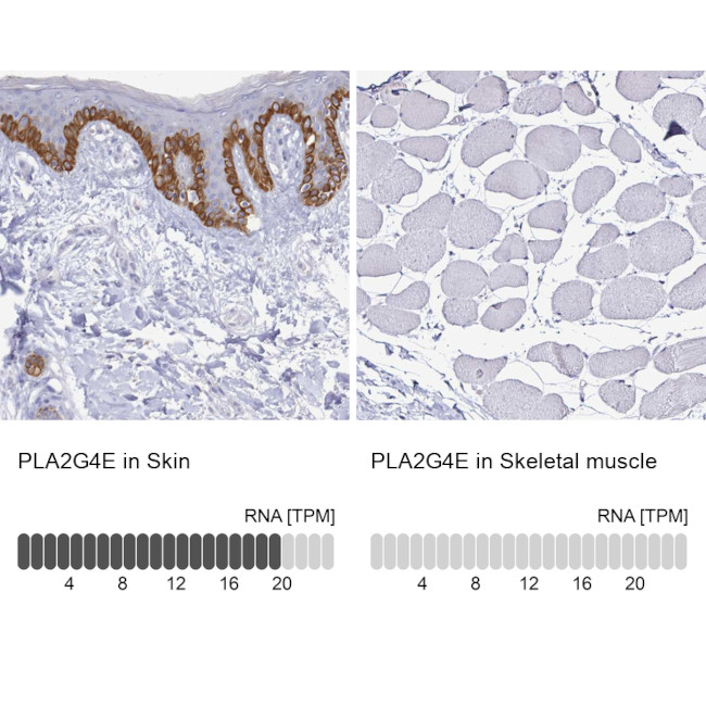 PLA2G4E Antibody in Immunohistochemistry (IHC)