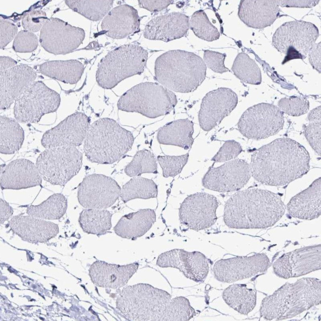 PLA2G4E Antibody in Immunohistochemistry (IHC)