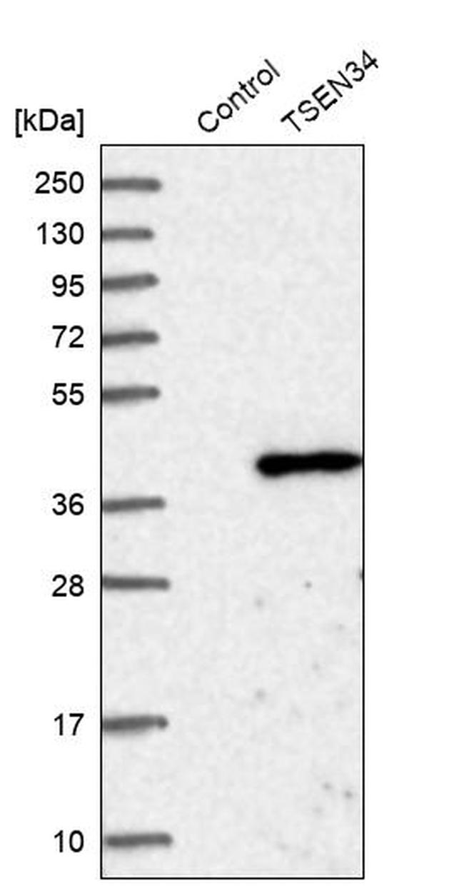 TSEN34 Antibody in Western Blot (WB)