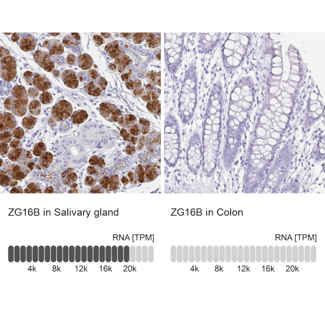 ZG16B Antibody in Immunohistochemistry (IHC)