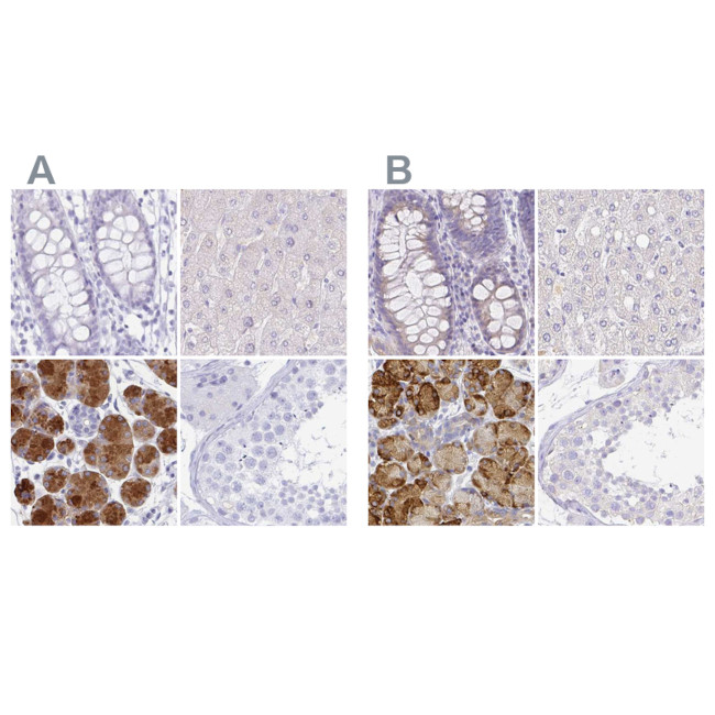 ZG16B Antibody in Immunohistochemistry (IHC)