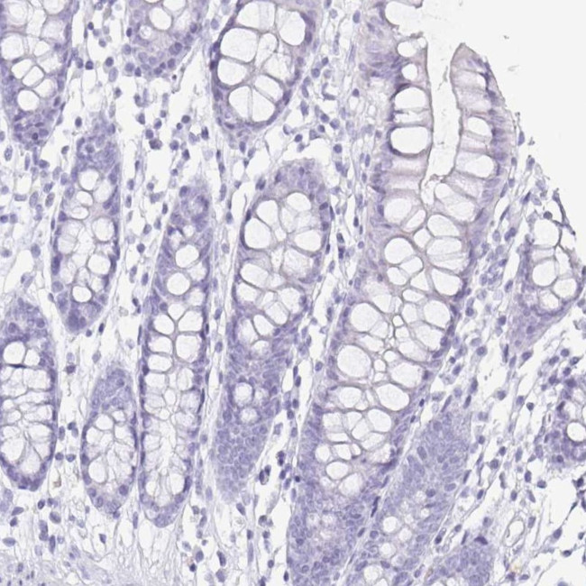 ZG16B Antibody in Immunohistochemistry (IHC)