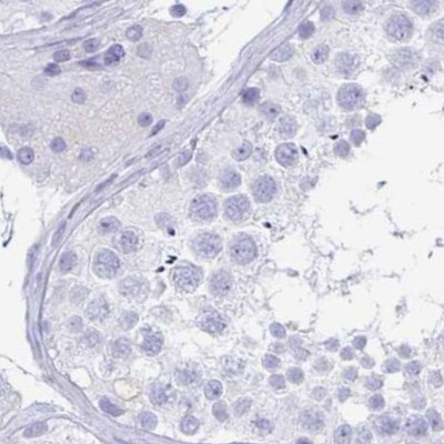 ZG16B Antibody in Immunohistochemistry (IHC)