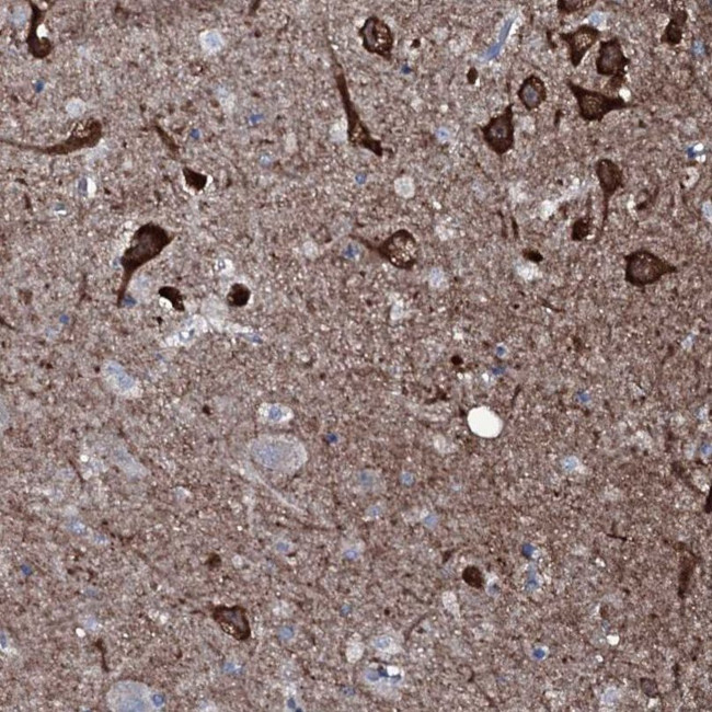 CR16 Antibody in Immunohistochemistry (IHC)