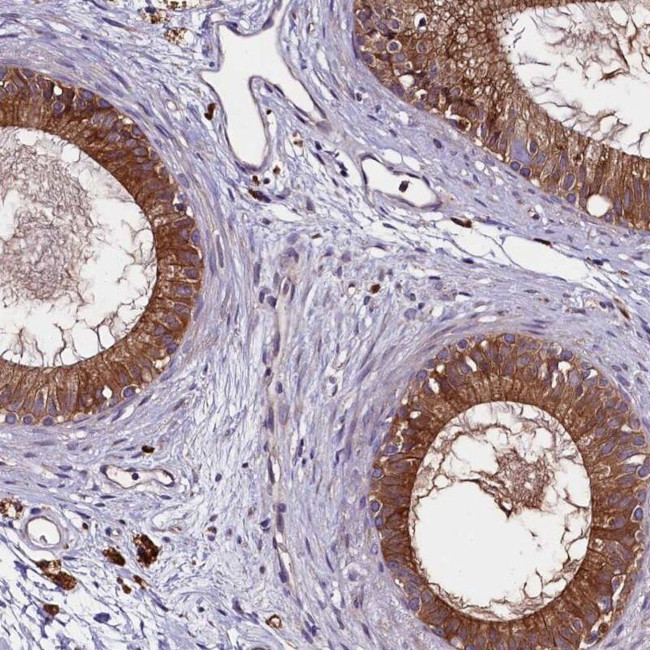 ZSWIM1 Antibody in Immunohistochemistry (IHC)