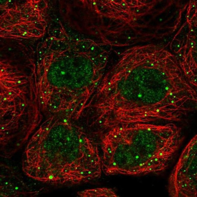 EDC4 Antibody in Immunocytochemistry (ICC/IF)