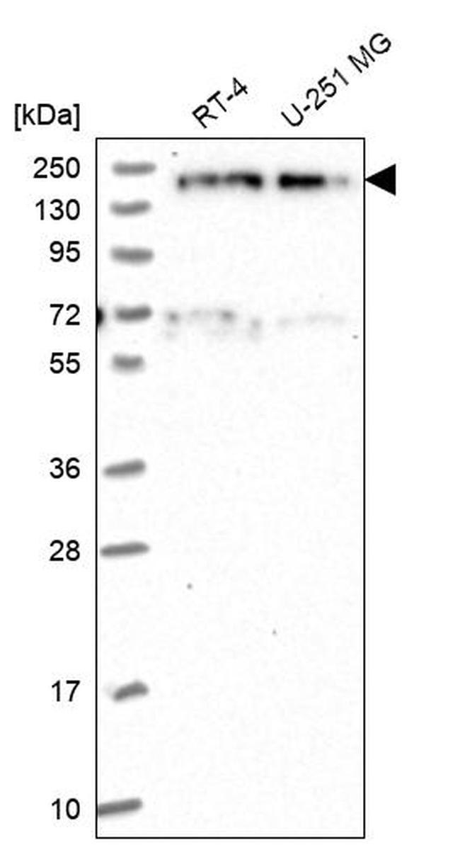 EDC4 Antibody in Western Blot (WB)