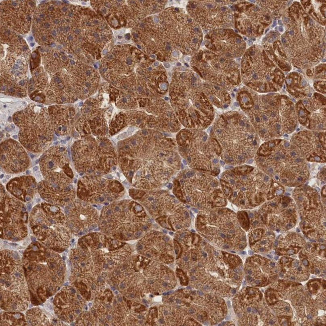 Katanin p80 Antibody in Immunohistochemistry (IHC)