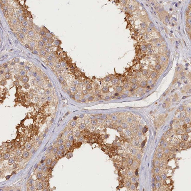 Katanin p80 Antibody in Immunohistochemistry (IHC)