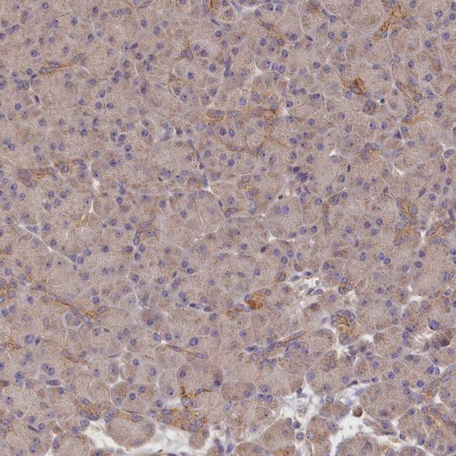 Katanin p80 Antibody in Immunohistochemistry (IHC)