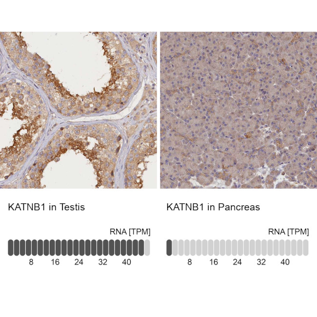 Katanin p80 Antibody