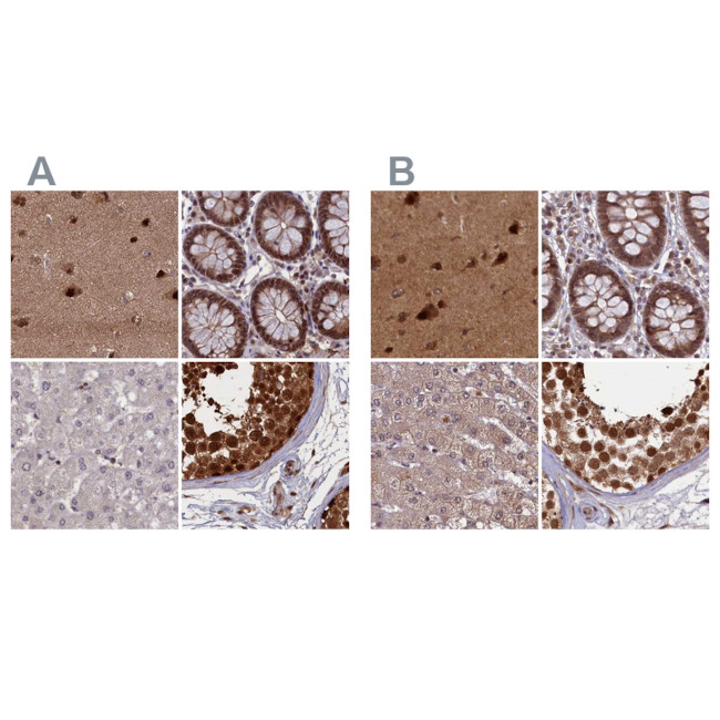 NAE1 Antibody in Immunohistochemistry (IHC)