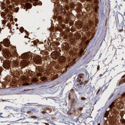 NAE1 Antibody in Immunohistochemistry (IHC)