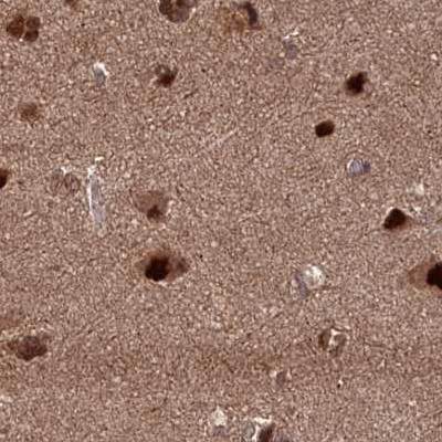 NAE1 Antibody in Immunohistochemistry (IHC)