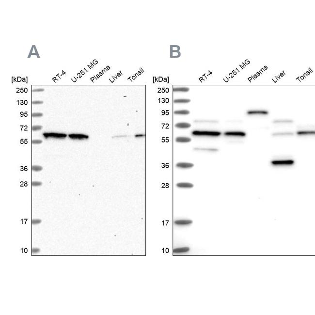 NAE1 Antibody in Western Blot (WB)