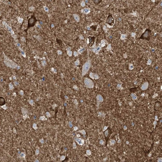 CR16 Antibody in Immunohistochemistry (IHC)