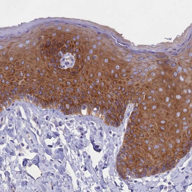 PPP1R13L Antibody in Immunohistochemistry (IHC)