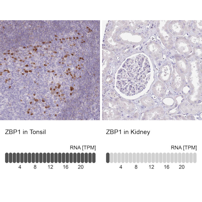 ZBP1 Antibody in Immunohistochemistry (IHC)