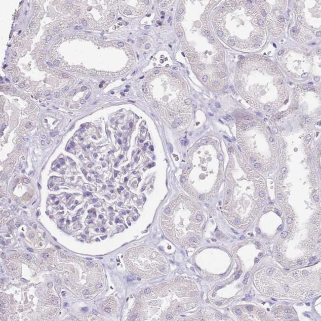 ZBP1 Antibody in Immunohistochemistry (IHC)