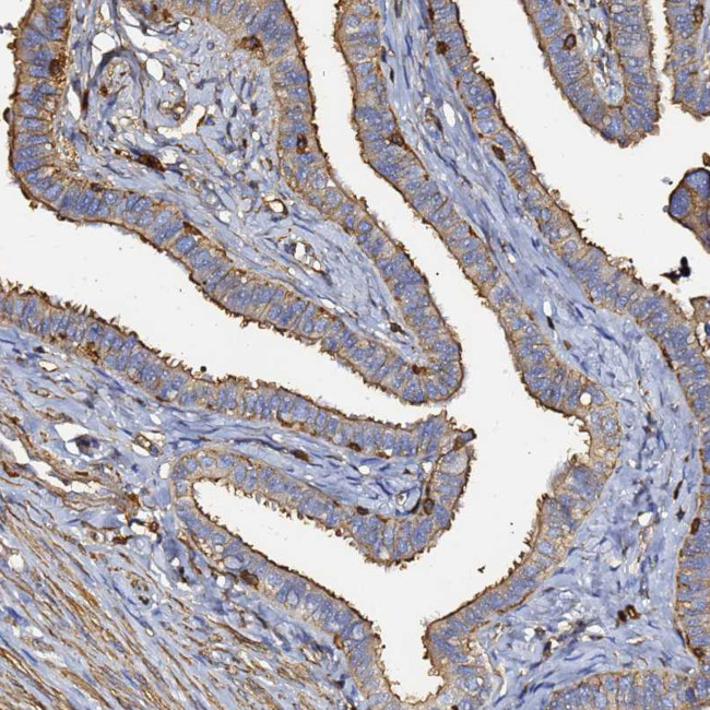 beta Actin Antibody in Immunohistochemistry (IHC)