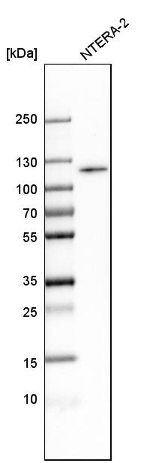 BICD1 Antibody in Western Blot (WB)