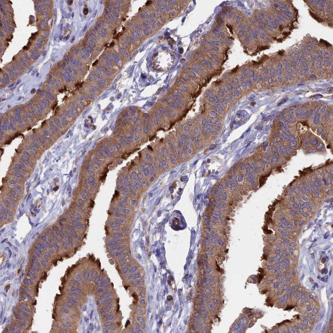 GAS8 Antibody in Immunohistochemistry (IHC)