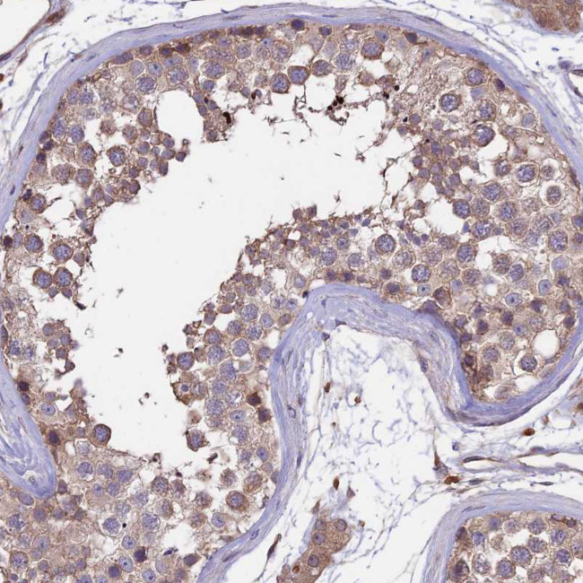 GAS8 Antibody in Immunohistochemistry (IHC)