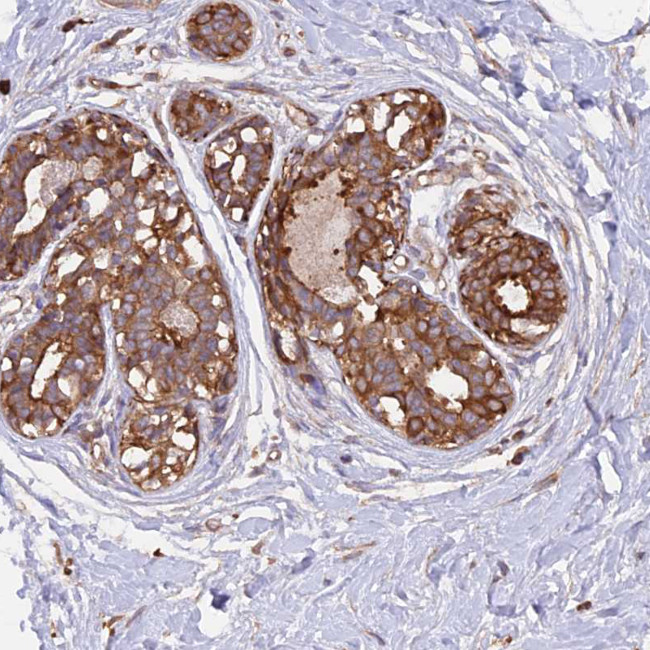 GAS8 Antibody in Immunohistochemistry (IHC)