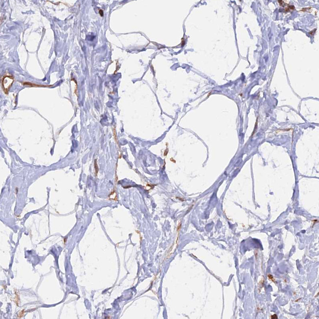 GAS8 Antibody in Immunohistochemistry (IHC)