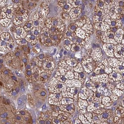 AMDHD2 Antibody in Immunohistochemistry (IHC)