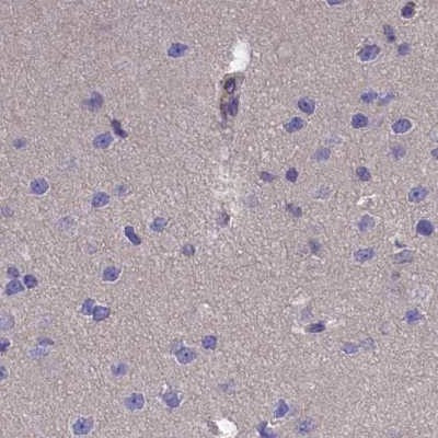 AMDHD2 Antibody in Immunohistochemistry (IHC)