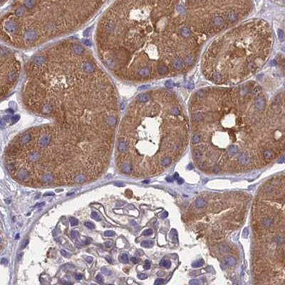 AMDHD2 Antibody in Immunohistochemistry (IHC)