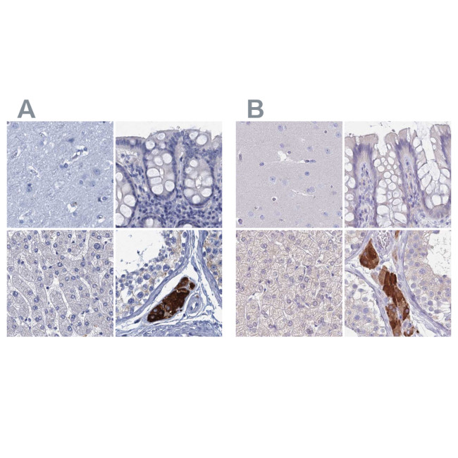 CYP51A1 Antibody in Immunohistochemistry (IHC)