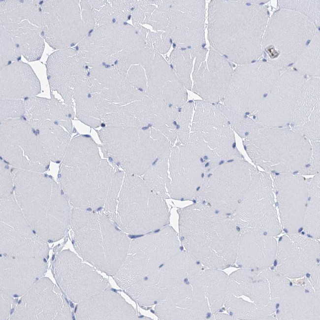 CYP51A1 Antibody in Immunohistochemistry (IHC)